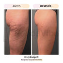 BodySculpt | Masajeador Anti-celulitis