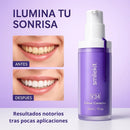 ADIÓS A LOS DIENTES AMARILLOS!! - SMILEKIT V34