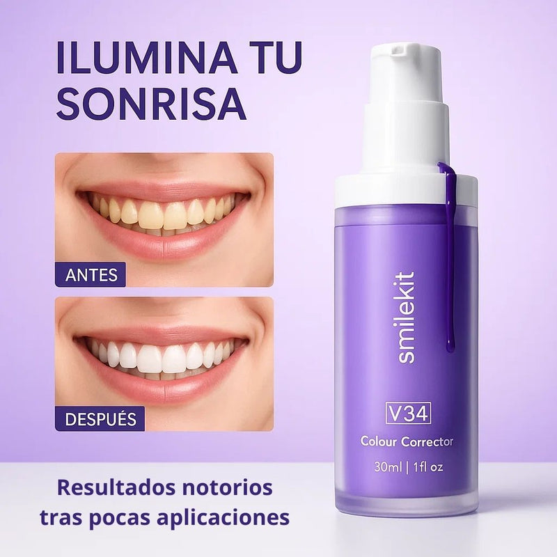 ADIÓS A LOS DIENTES AMARILLOS!! - SMILEKIT V34